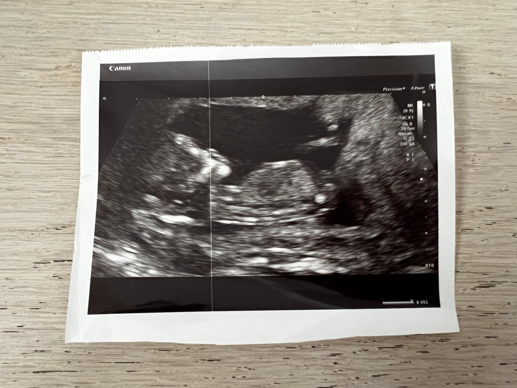 The Sonographer & The Vending&nbsp;Machine